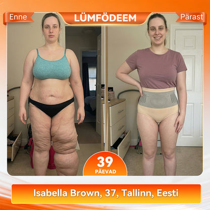 𝐀𝐦𝐞𝐭𝐥𝐢𝐤 𝐛𝐫ä𝐧𝐝𝐢𝐩𝐨𝐨𝐝 | 🩲𝐏𝐀𝐔𝐑𝐀𝐉𝐔®𝟐𝟎𝟐𝟔 𝐌𝐎𝐑𝐈𝐍𝐆𝐀 & 𝐁𝐄𝐑𝐁𝐄𝐑𝐈𝐈𝐍 𝐍𝐄𝐋𝐈 Ü𝐇𝐄𝐒 𝐌𝐈𝐊𝐑𝐎𝐎𝐒𝐀𝐊𝐄𝐒𝐓𝐄 𝐕𝐎𝐑𝐌𝐈𝐕 𝐉𝐀 𝐑𝐀𝐒𝐕𝐀𝐏Õ𝐋𝐄𝐓𝐀𝐕 𝐋Ü𝐇𝐈𝐊𝐔𝐔𝐑🌳